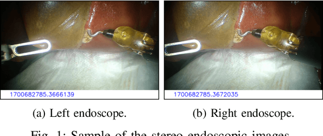 Figure 1 for Comprehensive Robotic Cholecystectomy Dataset (CRCD): Integrating Kinematics, Pedal Signals, and Endoscopic Videos