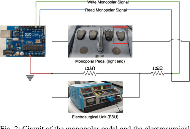 Figure 2 for Comprehensive Robotic Cholecystectomy Dataset (CRCD): Integrating Kinematics, Pedal Signals, and Endoscopic Videos