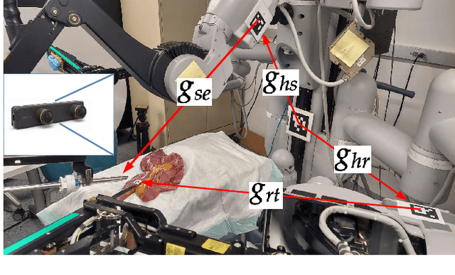 Figure 4 for Comprehensive Robotic Cholecystectomy Dataset (CRCD): Integrating Kinematics, Pedal Signals, and Endoscopic Videos
