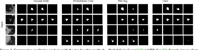 Figure 4 for Ambiguous Medical Image Segmentation using Diffusion Models