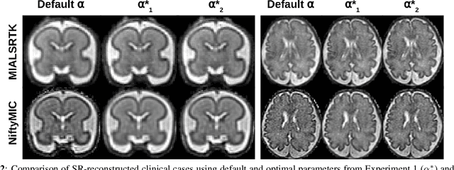 Figure 3 for Simulation-based parameter optimization for fetal brain MRI super-resolution reconstruction
