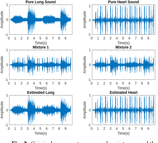 Figure 3 for A New Non-Negative Matrix Factorization Approach for Blind Source Separation of Cardiovascular and Respiratory Sound Based on the Periodicity of Heart and Lung Function