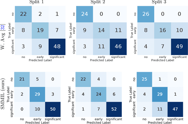 Figure 4 for Semi-Supervised Multimodal Multi-Instance Learning for Aortic Stenosis Diagnosis