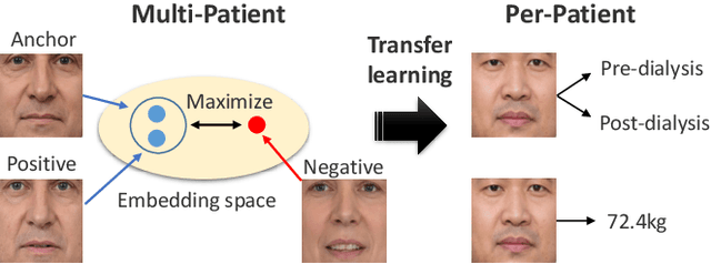 Figure 1 for Edema Estimation From Facial Images Taken Before and After Dialysis via Contrastive Multi-Patient Pre-Training
