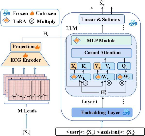 Figure 3 for Electrocardiogram Instruction Tuning for Report Generation