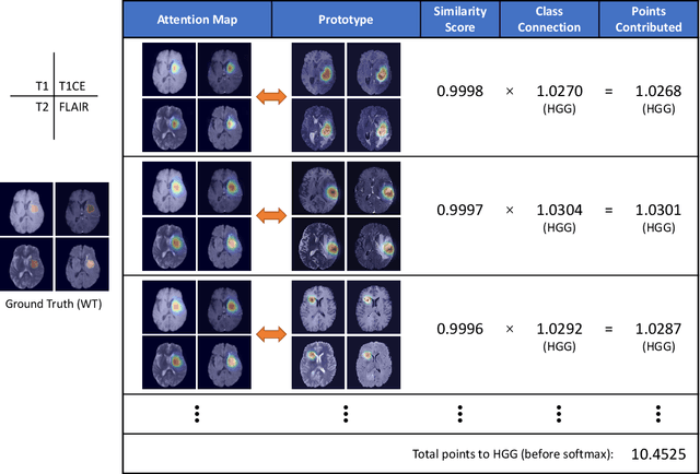 Figure 3 for MProtoNet: A Case-Based Interpretable Model for Brain Tumor Classification with 3D Multi-parametric Magnetic Resonance Imaging