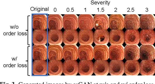 Figure 4 for Disease Severity Regression with Continuous Data Augmentation