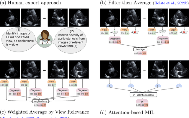 Figure 1 for Detecting Heart Disease from Multi-View Ultrasound Images via Supervised Attention Multiple Instance Learning