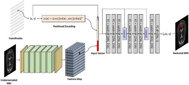 Figure 1 for Batch Implicit Neural Representation for MRI Parallel Reconstruction