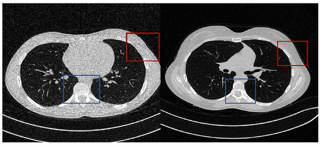 Figure 1 for QS-ADN: Quasi-Supervised Artifact Disentanglement Network for Low-Dose CT Image Denoising by Local Similarity Among Unpaired Data