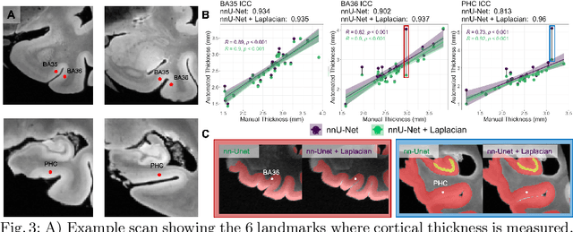 Figure 4 for Improved Segmentation of Deep Sulci in Cortical Gray Matter Using a Deep Learning Framework Incorporating Laplace's Equation