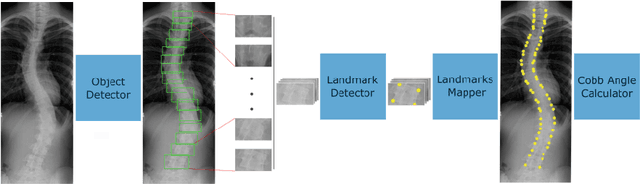 Figure 1 for Scoliosis Detection using Deep Neural Network