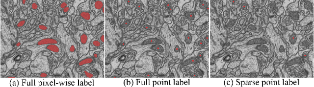 Figure 1 for WDA-Net: Weakly-Supervised Domain Adaptive Segmentation of Electron Microscopy