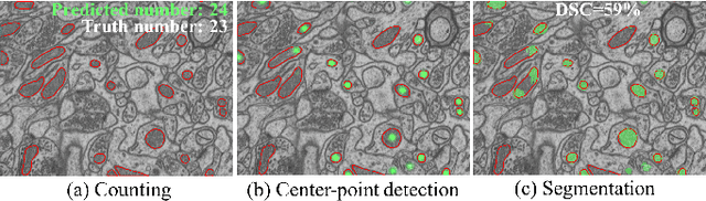 Figure 2 for WDA-Net: Weakly-Supervised Domain Adaptive Segmentation of Electron Microscopy
