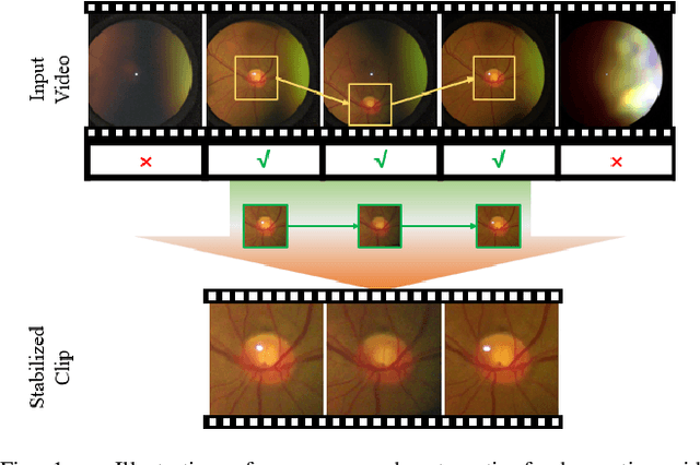 Figure 1 for Autonomous Stabilization of Retinal Videos for Streamlining Assessment of Spontaneous Venous Pulsations