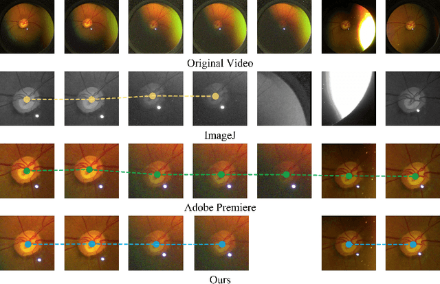 Figure 4 for Autonomous Stabilization of Retinal Videos for Streamlining Assessment of Spontaneous Venous Pulsations