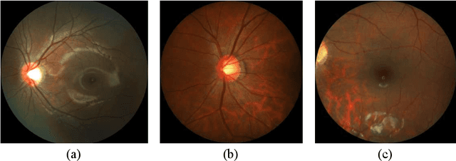 Figure 2 for PALM: Open Fundus Photograph Dataset with Pathologic Myopia Recognition and Anatomical Structure Annotation