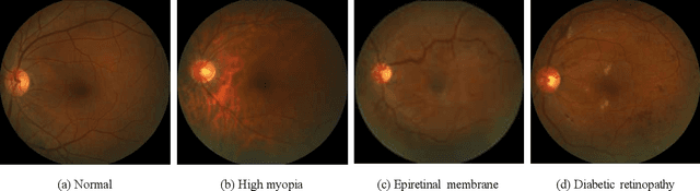 Figure 3 for PALM: Open Fundus Photograph Dataset with Pathologic Myopia Recognition and Anatomical Structure Annotation