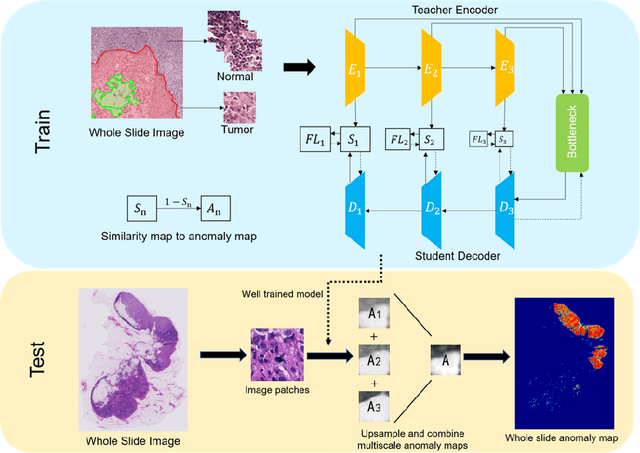 Figure 1 for Whole-slide-imaging Cancer Metastases Detection and Localization with Limited Tumorous Data