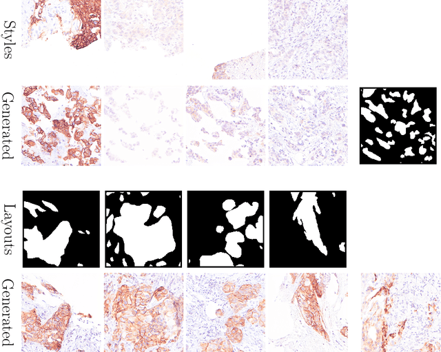 Figure 1 for Style-Extracting Diffusion Models for Semi-Supervised Histopathology Segmentation