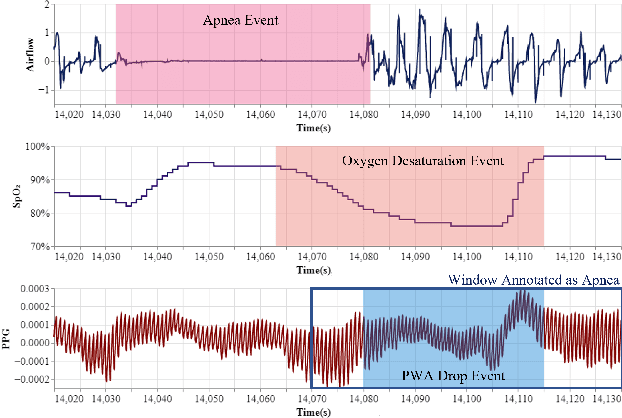 Figure 3 for ApSense: Data-driven Algorithm in PPG-based Sleep Apnea Sensing