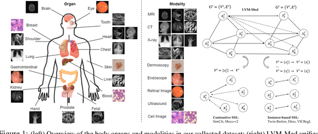 Figure 1 for LVM-Med: Learning Large-Scale Self-Supervised Vision Models for Medical Imaging via Second-order Graph Matching
