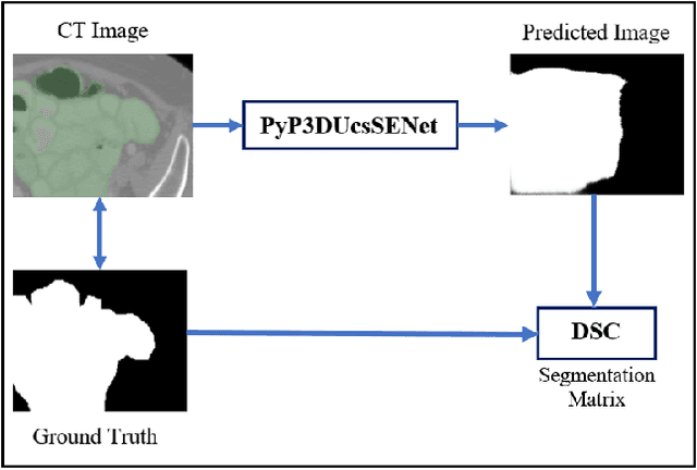 Figure 2 for Attention and Pooling based Sigmoid Colon Segmentation in 3D CT images