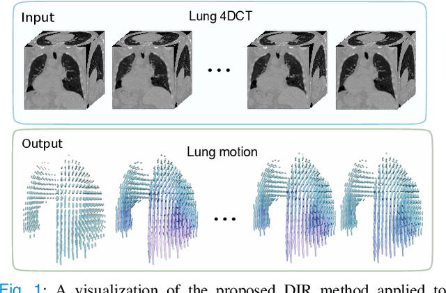 Figure 1 for ORRN: An ODE-based Recursive Registration Network for Deformable Respiratory Motion Estimation with Lung 4DCT Images