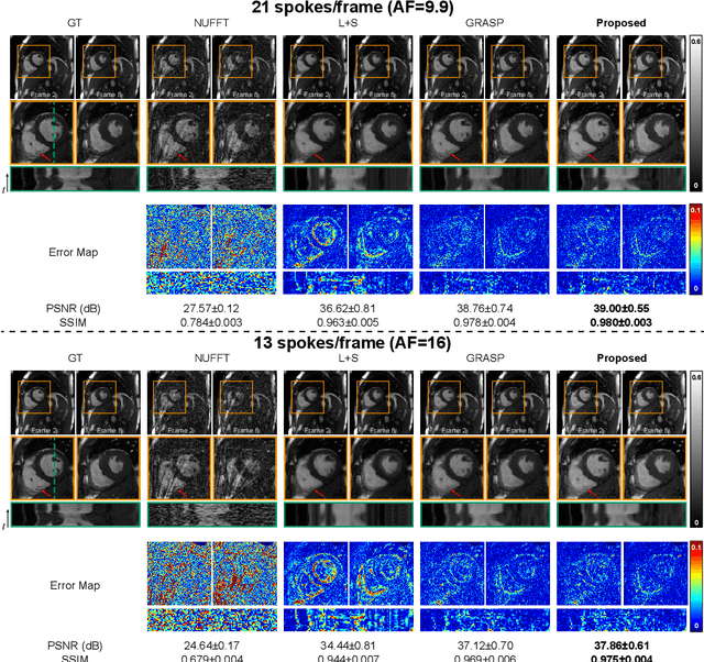 Figure 2 for Spatiotemporal implicit neural representation for unsupervised dynamic MRI reconstruction