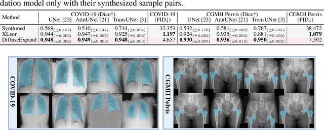 Figure 4 for DiffuseExpand: Expanding dataset for 2D medical image segmentation using diffusion models