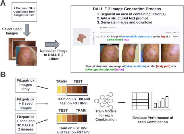 Figure 1 for Improving dermatology classifiers across populations using images generated by large diffusion models