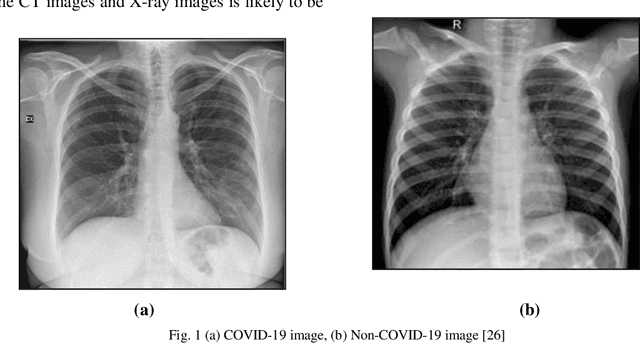 Figure 1 for Automatic Detection and Classification of Corona Infection (COVID-19) from X-ray Images Using Convolution Neural Network