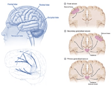 Figure 3 for Epilepsy Seizure Detection: Anatomy and Analysis