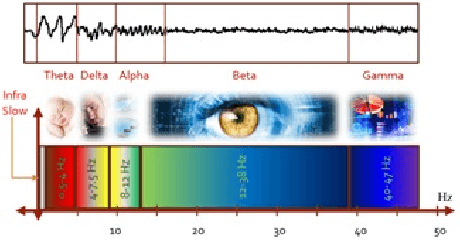 Figure 4 for Epilepsy Seizure Detection: Anatomy and Analysis