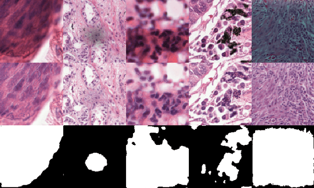 Figure 3 for Artifact Removal in Histopathology Images