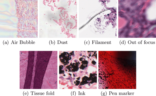 Figure 4 for Artifact Removal in Histopathology Images