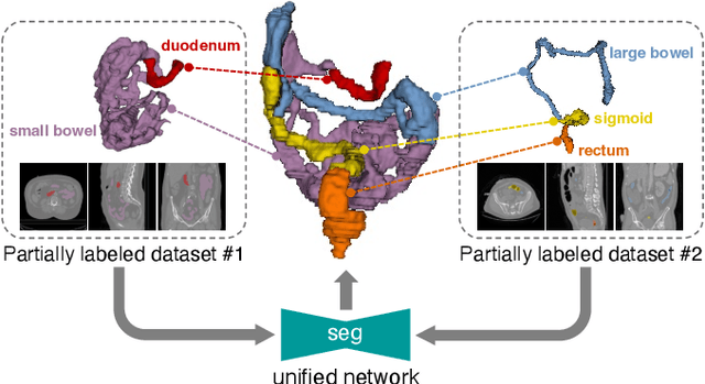 Figure 1 for COSST: Multi-organ Segmentation with Partially Labeled Datasets Using Comprehensive Supervisions and Self-training