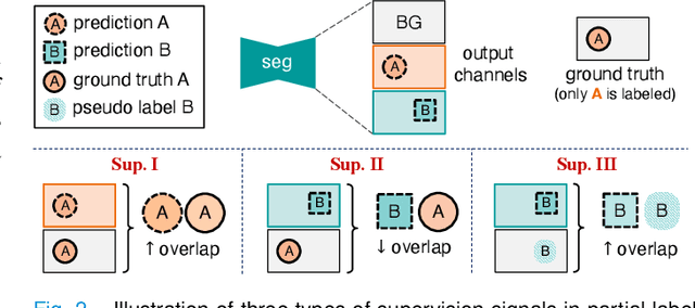 Figure 4 for COSST: Multi-organ Segmentation with Partially Labeled Datasets Using Comprehensive Supervisions and Self-training