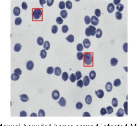 Figure 1 for Utilizing Segment Anything Model For Assessing Localization of GRAD-CAM in Medical Imaging