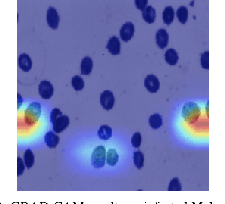 Figure 3 for Utilizing Segment Anything Model For Assessing Localization of GRAD-CAM in Medical Imaging