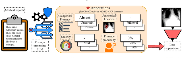 Figure 1 for Enhancing chest X-ray datasets with privacy-preserving large language models and multi-type annotations: a data-driven approach for improved classification