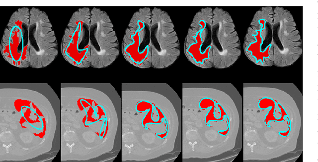 Figure 3 for Segment Anything Model for Medical Images?