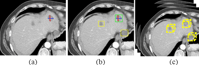 Figure 1 for An End-to-End Framework For Universal Lesion Detection With Missing Annotations