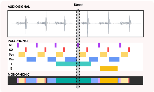 Figure 2 for Training one model to detect heart and lung sound events from single point auscultations