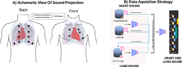 Figure 3 for Training one model to detect heart and lung sound events from single point auscultations
