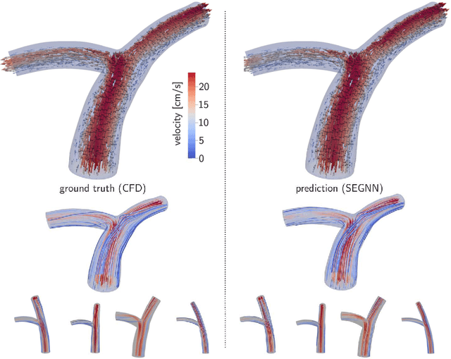 Figure 3 for SE(3) symmetry lets graph neural networks learn arterial velocity estimation from small datasets