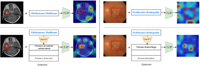 Figure 1 for A ChatGPT Aided Explainable Framework for Zero-Shot Medical Image Diagnosis