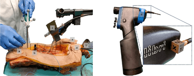 Figure 3 for Automatic breach detection during spine pedicle drilling based on vibroacoustic sensing