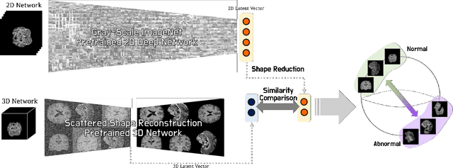 Figure 3 for Joint Embedding of 2D and 3D Networks for Medical Image Anomaly Detection