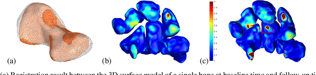 Figure 2 for 3D Patient-specific Modelling and Characterisation of Muscle-Skeletal Districts